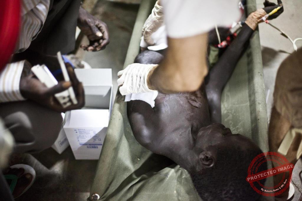 Scores treated for gunshot wounds in Nasir County