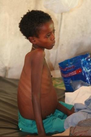 Team to probe food aid mismanagement claims in NBG